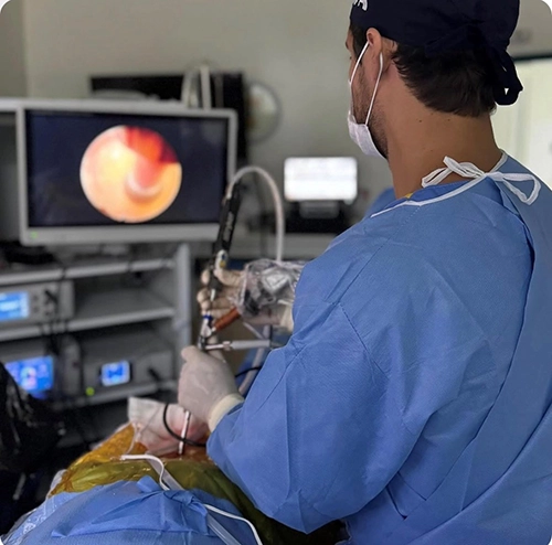 Detalhe técnico da endoscopia